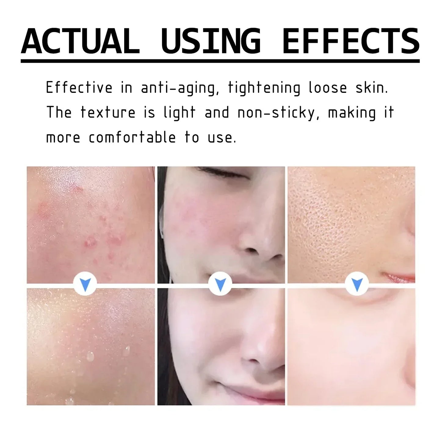 Hyaluronic The Korean Acid Moisturizing Face Lifting Nourishing Repair