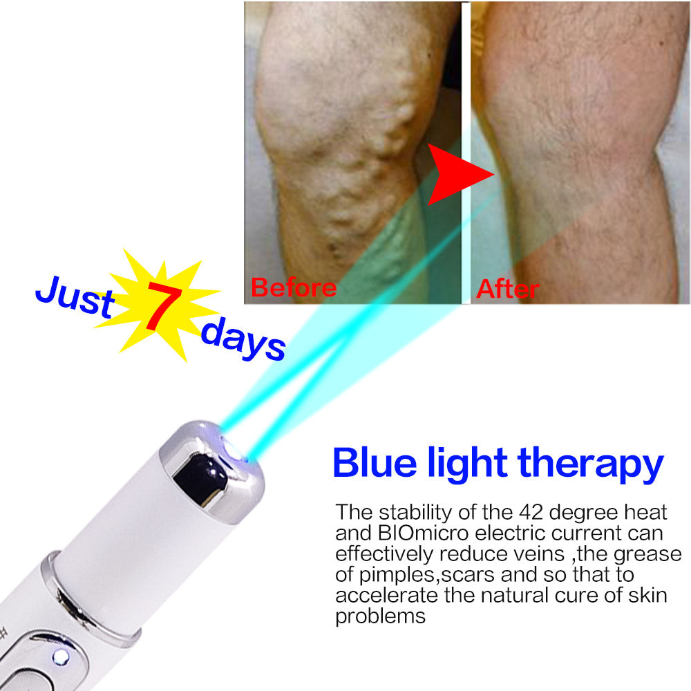 Blue Light Laser Pen  Wrinkle Removal, Anti Varicose & Spider Vein Eraser