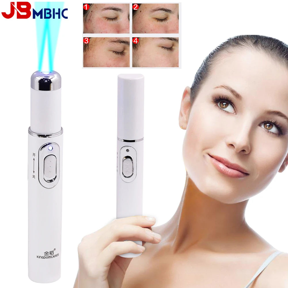 Blue Light Laser Pen  Wrinkle Removal, Anti Varicose & Spider Vein Eraser