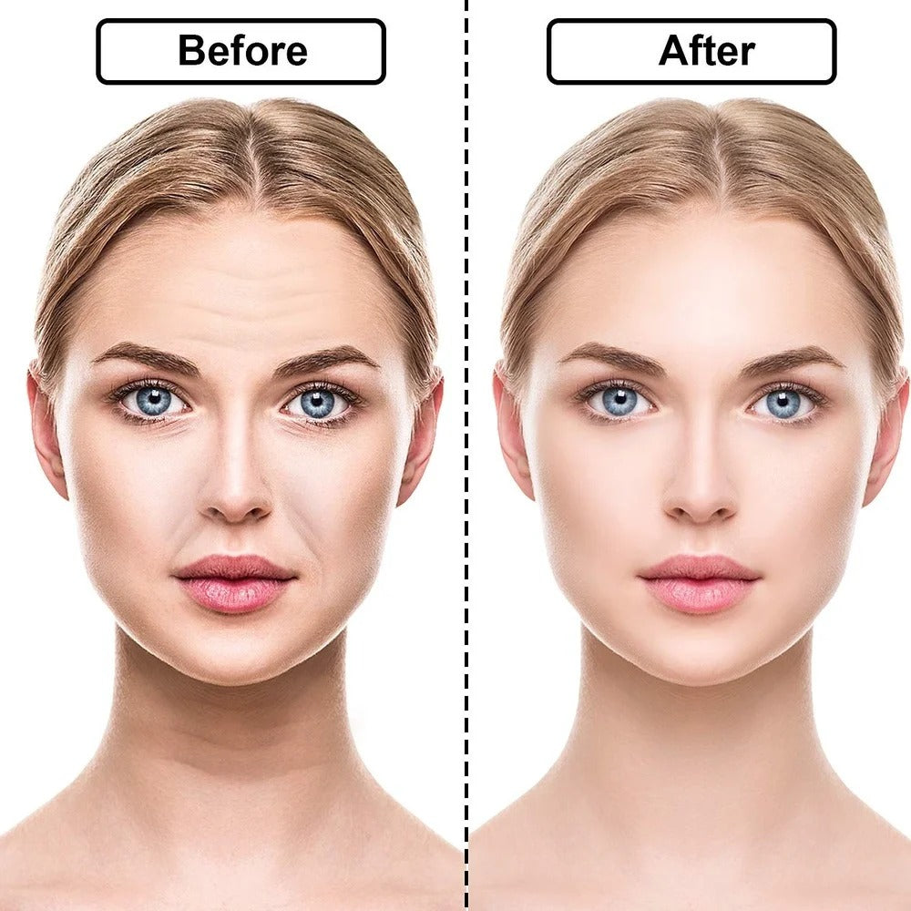 Wrinkle Removing Transparent Reusable Silicone Stickers ForForehead, Neck, & Eye Face Lifting Patches