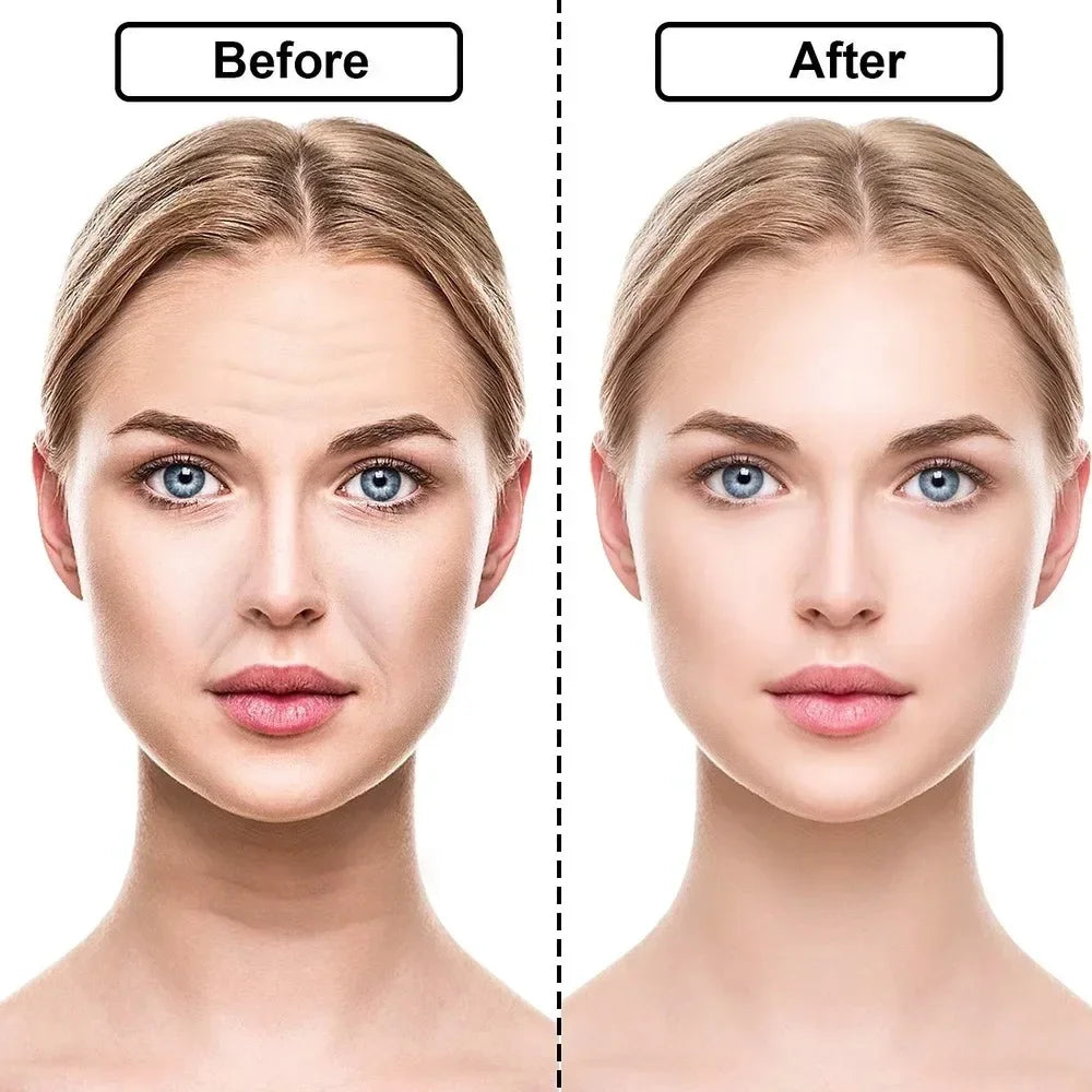 Wrinkle Removing Transparent Reusable Silicone Stickers ForForehead, Neck, & Eye Face Lifting Patches
